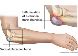 What are some common disorders of the muscular system?