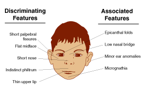 Essay on treacher collins syndrome