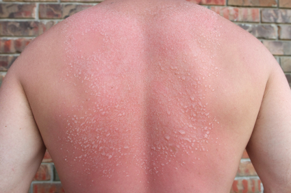 Rash 101: The Most Common Types of Skin Rashes