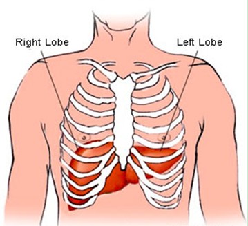 What causes a pain in the back in the kidney area?