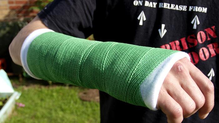 How Can You Break Wrist on Purpose? | New Health Guide