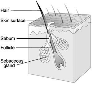Multiple Hairs Growing Out of One Follicle, What to Do? | New Health Guide Multiple Hairs Growing Out of One Follicle, What to Do? | New Health Guide